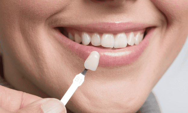 Cosmetic Dentist Dubai: Transform Your Smile with Advanced Aesthetic Dentistry